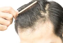 How To Stop Hairfall Hairfall