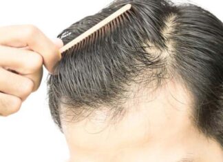 How To Stop Hairfall Hairfall