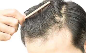 How To Stop Hairfall Hairfall